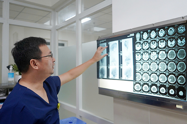 Hình ảnh dị dạng mạch máu não của bệnh nhân trước phẫu thuật. 