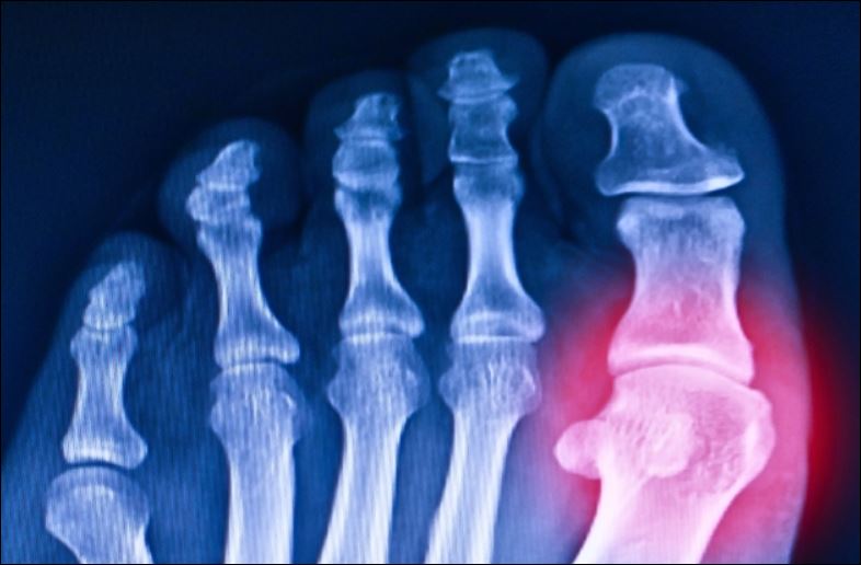 Ảnh minh họa. Nguồn: Tonpor Kasa/Canva.