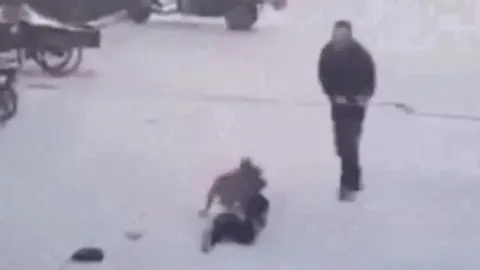 CLIP: Đang chơi đùa, bé gái 8 tuổi bị chó pitbull tấn công giữa phố và màn giải cứu kịch tính