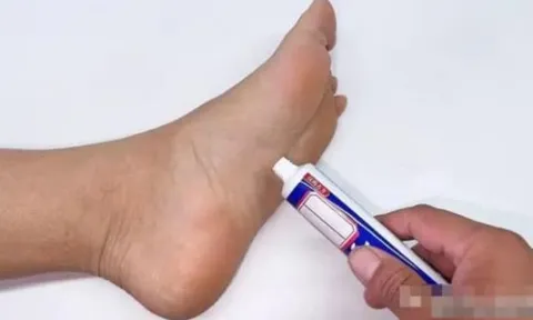 Kem đánh răng bôi vào lòng bàn chân có tác dụng rất tốt, giải quyết được nhiều vấn đề trong gia đình