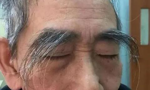 Lông mày của một người đàn ông lớn tuổi đột nhiên dài ra có nghĩa là gì? Nó có liên quan đến tuổi thọ?