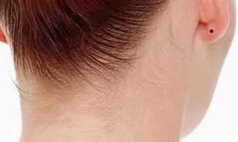 4 nốt ruồi tốt lành hoặc giàu có hoặc quyền quý đều được thừa kế tài sản của tổ tiên và kết hôn với một người đàn ông giàu có