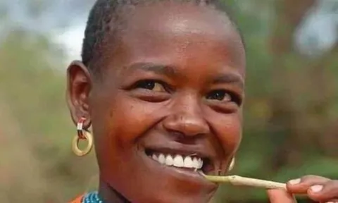 Người Châu Phi ít dùng kem đánh răng, tại sao răng họ vẫn trắng? Nó không chỉ liên quan đến 'màu da đen'