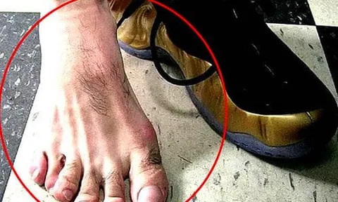 Câu tục ngữ nông thôn: “Ngón chân thứ hai dài hơn ngón cái, lớn lên không hiếu thuận”, đoán tính cách qua tướng ngón chân