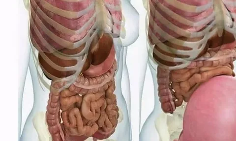 Bụng phụ nữ ngày càng lớn sau khi mang thai, vậy các cơ quan nội tạng ở đâu? Đây là bức tranh để bạn hiểu sự hy sinh của người phụ nữ