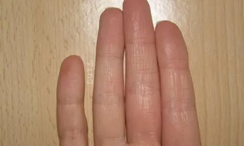 Nhiều người không biết rằng 'độ dài ngón tay út' quyết định cuộc đời của bạn, không ngờ nó còn chính xác hơn cả nhìn mặt!