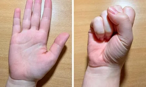 Ấn vào ngón tay cái có thể giảm bớt lo lắng và 8 mẹo giúp bạn cảm thấy thư thái, bình tĩnh và hài lòng