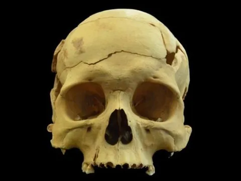 Hộp sọ 2.700 năm tuổi hé lộ điều gây sốc về y học thời cổ đại, thế giới chấn động không dám tin