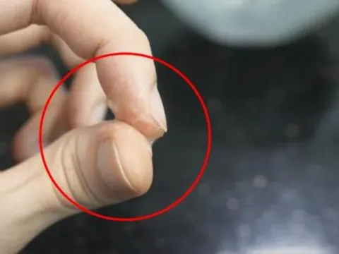 Đừng hoảng hốt khi keo 502 dính tay, mẹo hay giúp bạn gỡ keo nhanh chóng, không đau, không để lại sẹo