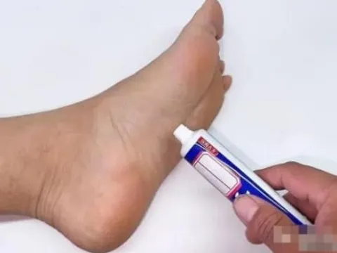 Kem đánh răng bôi vào lòng bàn chân có tác dụng rất tốt, giải quyết được nhiều vấn đề trong gia đình