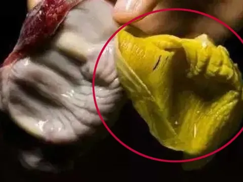 Màng mề gà còn có tác dụng hơn 'thịt gà', chỉ người biết tác dụng mới thấy nó quý hơn 'đông trùng hạ thảo'