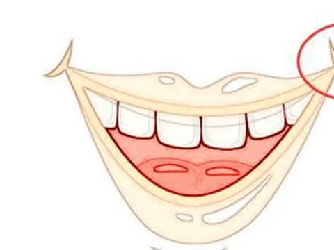 Trên khuôn mặt có 4 nốt ruồi không may mắn sẽ thu hút kẻ xấu, hủy hoại vận may của bạn, thậm chí loại bỏ một trong số chúng cũng vô ích!