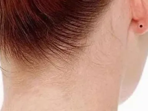 4 nốt ruồi tốt lành hoặc giàu có hoặc quyền quý đều được thừa kế tài sản của tổ tiên và kết hôn với một người đàn ông giàu có