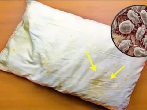 Thứ bẩn nhất trên giường không phải là ga trải giường mà là 'nó'. Nhiều người chưa giặt chút nào!