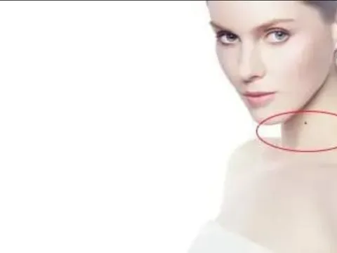 Nếu trên cơ thể bạn có “ba” nốt ruồi tốt này thì bạn sẽ được hưởng phúc ba đời