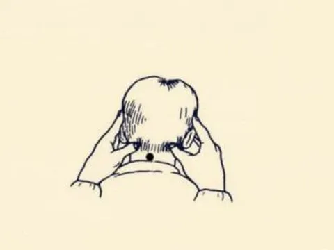 Nốt ruồi trên sáu bộ phận này của cơ thể là nơi dễ kiếm tiền nhất, và tất cả đều 'đáng sinh tiền'