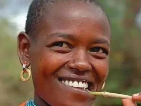 Người Châu Phi ít dùng kem đánh răng, tại sao răng họ vẫn trắng? Nó không chỉ liên quan đến 'màu da đen'