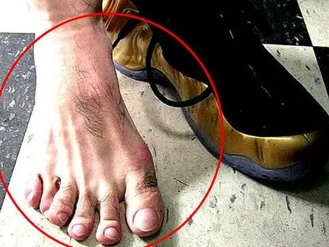 Câu tục ngữ nông thôn: “Ngón chân thứ hai dài hơn ngón cái, lớn lên không hiếu thuận”, đoán tính cách qua tướng ngón chân