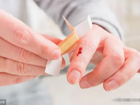 Nằm mơ thấy người khác chảy máu có ý nghĩa gì? Đọc xong tôi mới biết bấy lâu nay hiểu sai