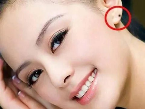 Nơi nào có nốt ruồi son là mệnh lấy được phú quý, ở đó chứa đựng sự giàu sang, đào hoa, phú quý may mắn