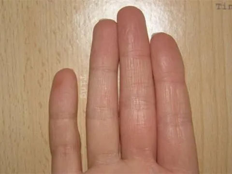 Nhiều người không biết rằng 'độ dài ngón tay út' quyết định cuộc đời của bạn, không ngờ nó còn chính xác hơn cả nhìn mặt!