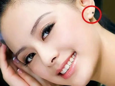 Phụ nữ có nốt ruồi giữa lông mày, dái tai và bụng thì may mắn như thế nào?