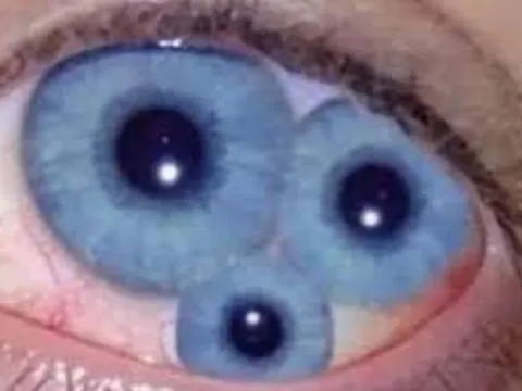 Mèo có đồng tử dọc, dê lại có đồng tử ngang – liệu đây có phải chỉ là sự khác biệt ngẫu nhiên hay ẩn chứa một bí mật tiến hóa đầy thú vị?