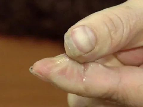 Keo 502 dính vào ngón tay khó gỡ, dạy bạn mẹo đơn giản khiến lớp keo cứng đầu bong ngay