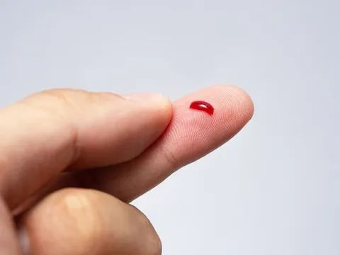 Vì sao máu lại có màu đỏ mà không phải là màu khác?