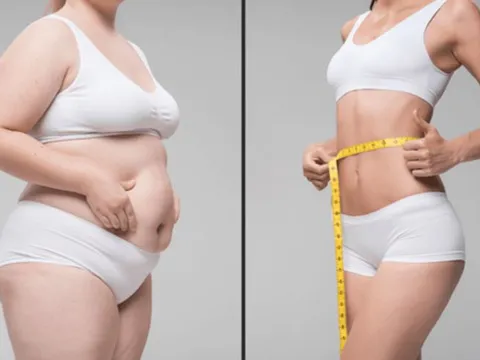 Sau khi giảm cân, lượng mỡ thừa và thịt biến đi đâu?