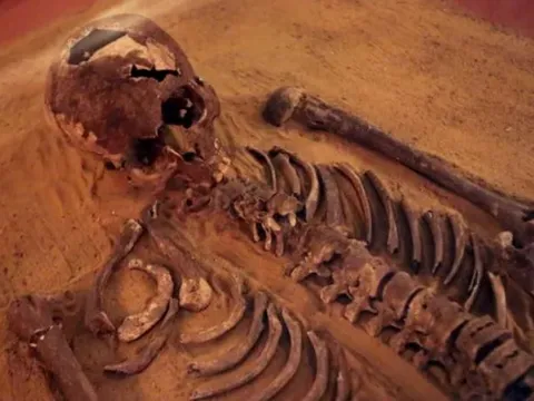 Làm thế nào các nhà khảo cổ xác định giới tính của một bộ xương?