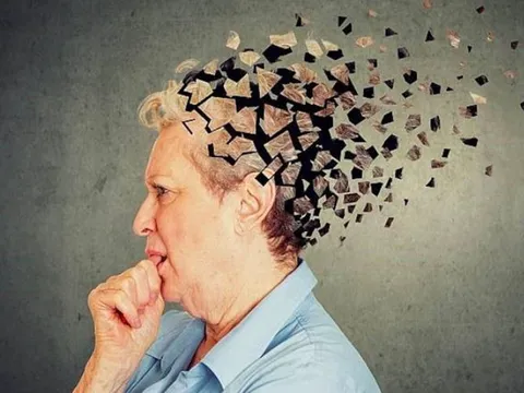 Nguồn gốc của chứng mất trí nhớ có thể bắt đầu từ thời thơ ấu, các chuyên gia cảnh báo