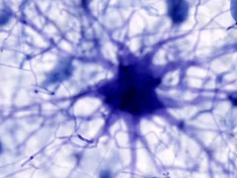 AI phát hiện ra nguyên nhân gây bệnh Alzheimer và có thể tìm ra phương pháp điều trị