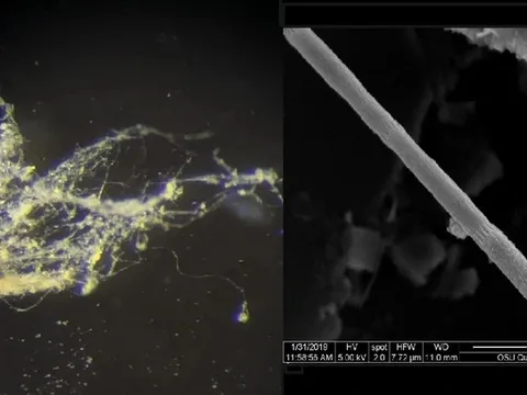 Phát hiện vi khuẩn dẫn điện như dây sống, mở ra tương lai cho công nghệ sinh học