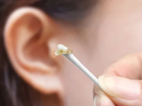 Sự thật ít biết về ráy tai - 'vệ sĩ thầm lặng' của cơ thể