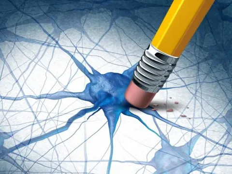 Khám phá hợp chất tự nhiên có khả năng loại bỏ protein gây bệnh Alzheimer