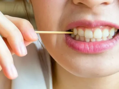 Tác hại không ngờ của việc xỉa răng bằng tăm