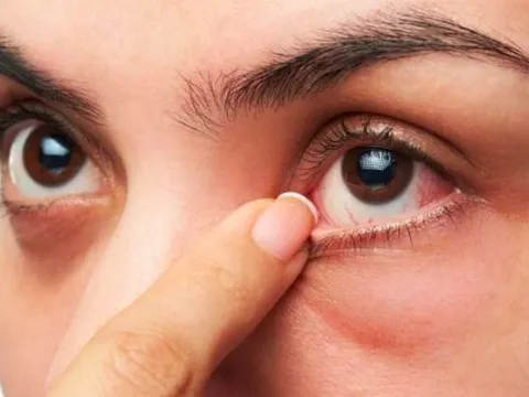 Cảnh báo từ chuyên gia: Hai dấu hiệu ngứa tưởng chừng vô hại lại là tín hiệu cảnh báo ung thư gan