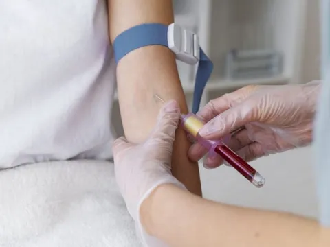 Lý do máu luôn được lấy từ tĩnh mạch thay vì từ động mạch