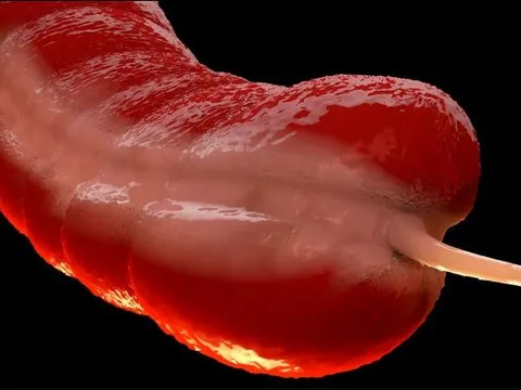 Một căn bệnh ung thư bị lãng quên đang gia tăng ở người trẻ khiến các chuyên gia bối rối