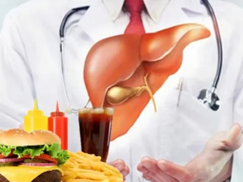 6 loại thực phẩm là 'kẻ thù nguy hiểm nhất' của gan 